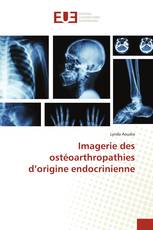 Imagerie des ostéoarthropathies d’origine endocrinienne