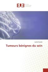 Tumeurs bénignes du sein