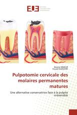 Pulpotomie cervicale des molaires permanentes matures