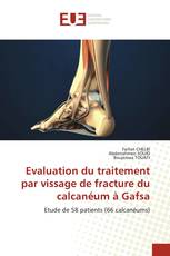 Evaluation du traitement par vissage de fracture du calcanéum à Gafsa