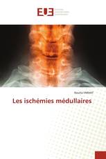 Les ischémies médullaires