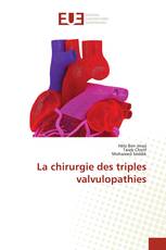 La chirurgie des triples valvulopathies