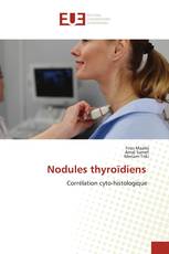 Nodules thyroïdiens