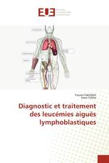 Diagnostic et traitement des leucémies aiguës lymphoblastiques