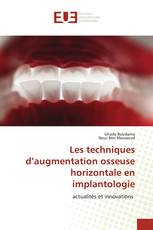 Les techniques d’augmentation osseuse horizontale en implantologie