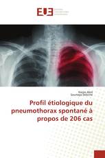 Profil étiologique du pneumothorax spontané à propos de 206 cas