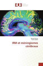 IRM et méningiomes cérébraux