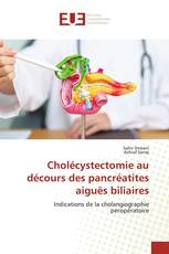 Cholécystectomie au décours des pancréatites aiguës biliaires