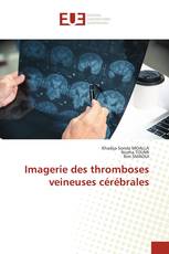 Imagerie des thromboses veineuses cérébrales