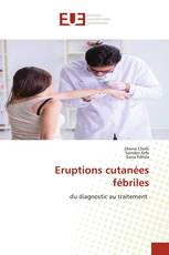 Eruptions cutanées fébriles