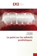 Le point sur les adhésifs prothétiques