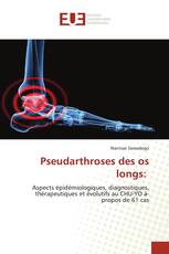 Pseudarthroses des os longs: