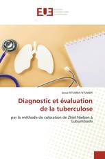 Diagnostic et évaluation de la tuberculose