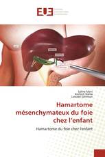 Hamartome mésenchymateux du foie chez l’enfant