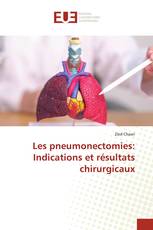 Les pneumonectomies: Indications et résultats chirurgicaux