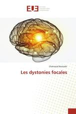 Les dystonies focales
