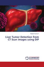 Liver Tumor Detection from CT Scan images using DIP