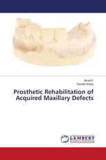 Prosthetic Rehabilitation of Acquired Maxillary Defects