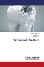 Vertical root fracture