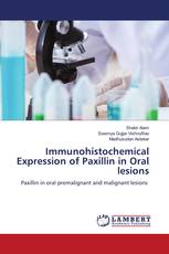 Immunohistochemical Expression of Paxillin in Oral lesions