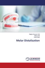 Molar Distalization