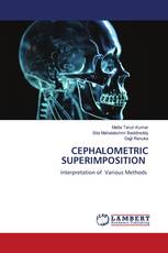 CEPHALOMETRIC SUPERIMPOSITION