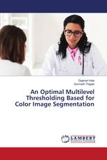 An Optimal Multilevel Thresholding Based for Color Image Segmentation