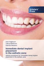 Immediate dental implant placement in the esthetic zone