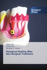 Periapical Healing After Non-Surgical Treatment