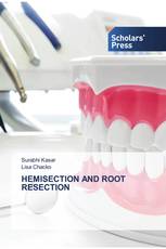 HEMISECTION AND ROOT RESECTION