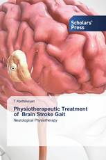 Physiotherapeutic Treatment of Brain Stroke Gait
