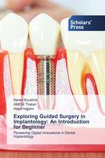 Exploring Guided Surgery in Implantology: An Introduction for Beginner