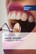 DENTAL VENEERS