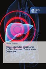 Hepatocellular carcinoma (HCC): Causes. Treatments. Overview