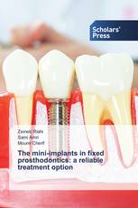 The mini-implants in fixed prosthodontics: a reliable treatment option