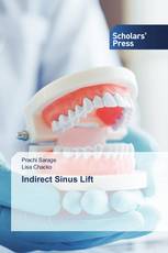 Indirect Sinus Lift