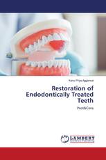 Restoration of Endodontically Treated Teeth