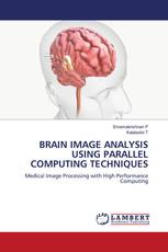 BRAIN IMAGE ANALYSIS USING PARALLEL COMPUTING TECHNIQUES