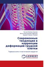 Современные тенденции в коррекции деформаций грудной клетки