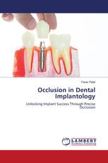 Occlusion in Dental Implantology