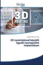 3D nyomtatással készülő egyedi nyeregízület implantátum