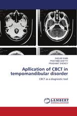 Apllication of CBCT in tempomandibular disorder