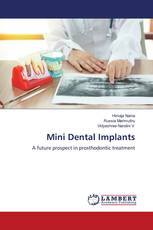 Mini Dental Implants