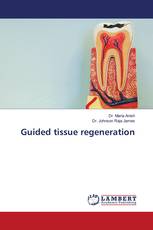 Guided tissue regeneration