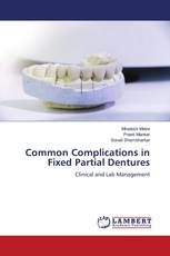 Common Complications in Fixed Partial Dentures