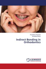 Indirect Bonding in Orthodontics