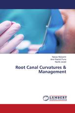 Root Canal Curvatures & Management