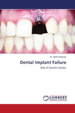 Dental Implant Failure
