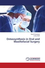 Osteosynthesis in Oral and Maxillofacial Surgery