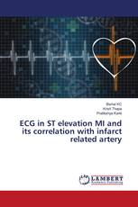 ECG in ST elevation MI and its correlation with infarct related artery